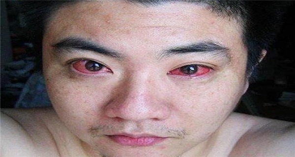 MAN DIAGNOSED WITH EYE CANCER BECAUSE OF DOING THIS AT NIGHT !
