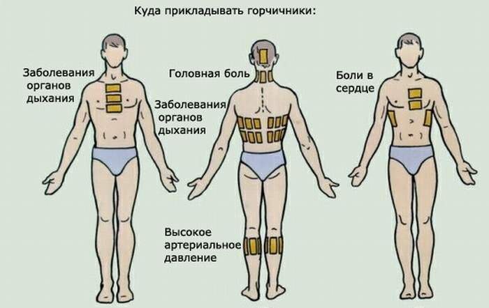Горчичники детям своими руками Горчичники детям своими руками