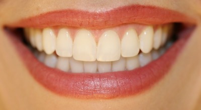 Причина улыбаться почаще: натуральное средство из куркумы для качественного отбеливания зубов!