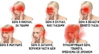 5 предупредительных сигналов: о чем говорит боль в разных частях головы?