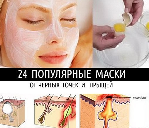24 популярные маски от черных точек и прыщей