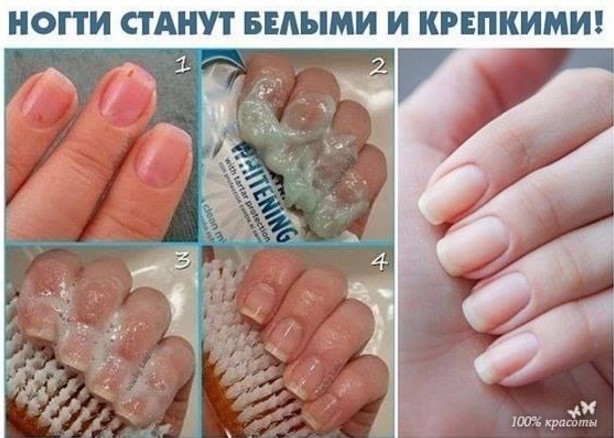 Чтобы ногти всегда выглядели ухоженными и были белыми, длинными и крепкими советую этот рецепт!
