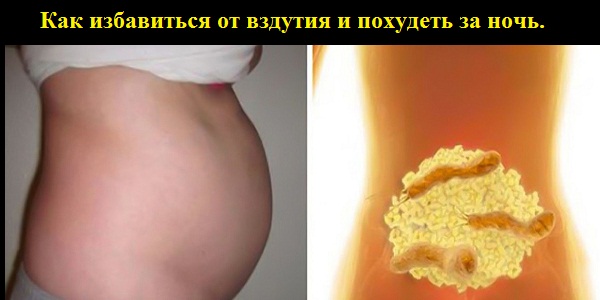Вот это поворот! Вот почему у тебя раздутый живот! Как избавиться от вздутия и похудеть за ночь