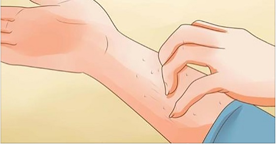 5 симптомов почечной недостаточности, которые вы, вероятнее всего, игнорируете!