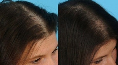 10 домашних масок от выпадения волос, после которых твоя шевелюра начнет расти с новой силой
