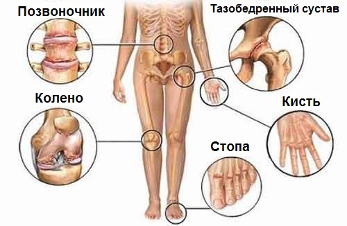 Попрощайся с болью в суставах! 5 полезных советов