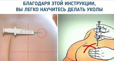 Как самостоятельно сделать укол? Подробная инструкция