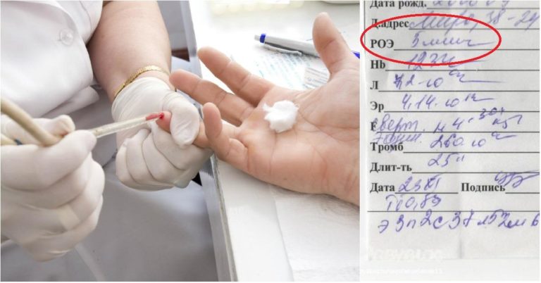 9 показателей крови, которые расскажут всё о здоровье: читай анализ правильно!