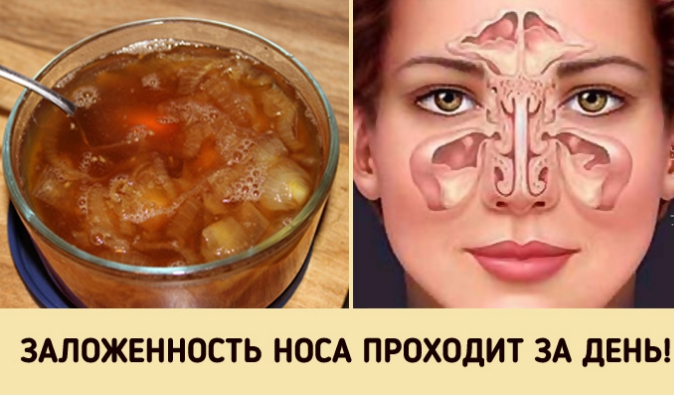 Супер-средство от заложенного носа. Будете свободно дышать уже на утро!