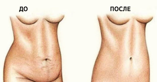 Стань легче за 4 дня! Эта смесь поможет сбросить 3 кг и уменьшить на 10 см талию быстро!