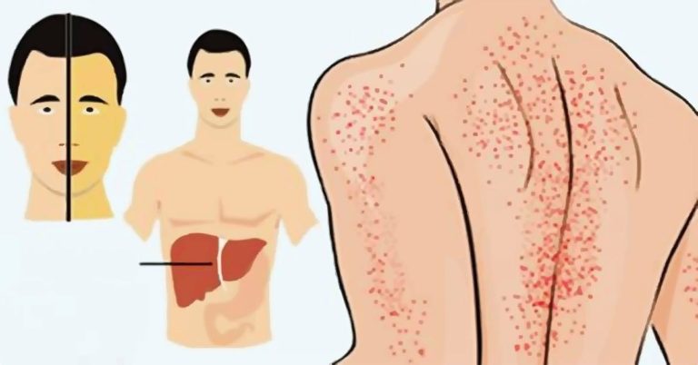 Мы сами убиваем наши почки! 10 привычек, о которых нужно навсегда забыть