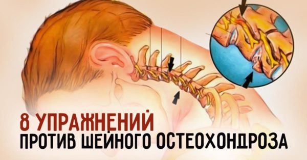8 потрясающих упражнений от шейного остеохондроза. Сделай шаг к здоровью!