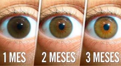 Естественный рецепт, чтобы победить катаракту и улучшить зрение всего за 3 месяца! Это очень просто! Избегайте хирургии!