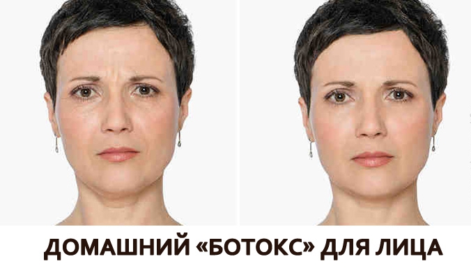 Домашний «ботокс» для лица