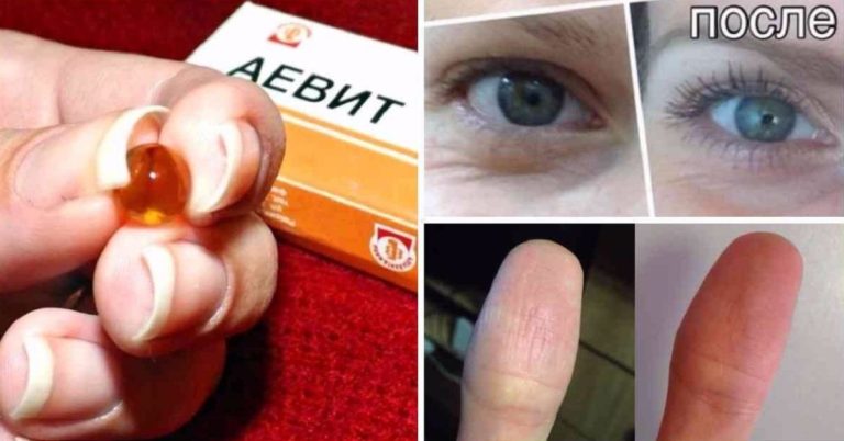 Лекарство «Аевит» творит чудеса! Действенное средство за копейки…