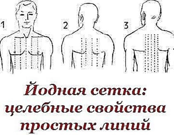 Йодная Сетка: Целебные Свойства Простых Линий