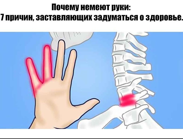 Почему немеют руки: 7 причин, заставляющих задуматься о здоровье