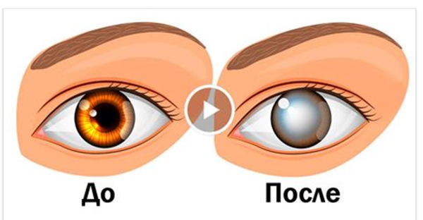 Офтальмологи предупреждают! Никогда не делайте этого! Это приводит к слепоте и не только…