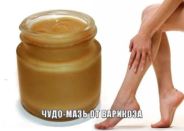 ЧУДО-МАЗЬ ОТ ВАРИКОЗА