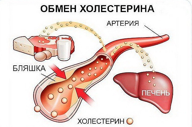 Уровень холестерина можно снизить без проблем!