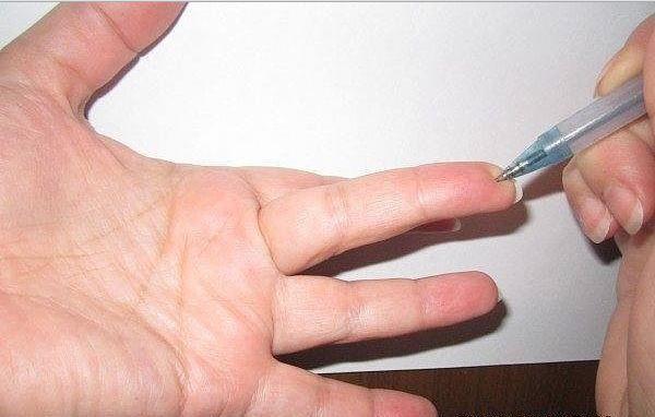 ЭТУ ТОЧКУ ИСПОЛЬЗУЮТ В ВОЕННОЙ МЕДИЦИНЕ!
