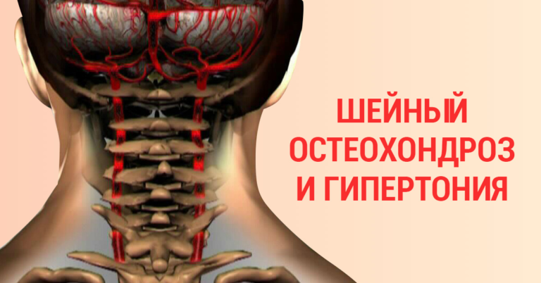 90 % трудоспособного населения страдает от шейного остеохондроза… Останови этот замкнутый круг!