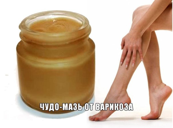 МАЗЬ, КОТОРАЯ ПОМОГЛА МОЕЙ МАМЕ ВЫЛЕЧИТЬ ВАРИКОЗ