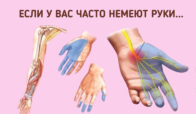 Почему немеют руки: 7 причин сходить к врачу