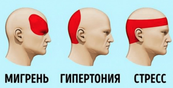Избавляюсь от головной боли только так и всего за 5 минут… забудь про таблетки навсегда!