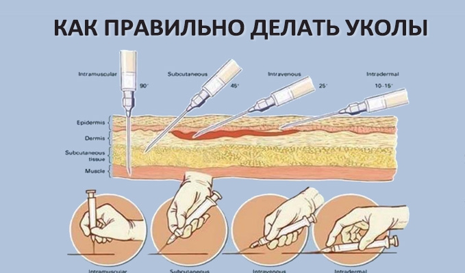 Как правильно и безопасно делать инъекции? Наглядная инструкция