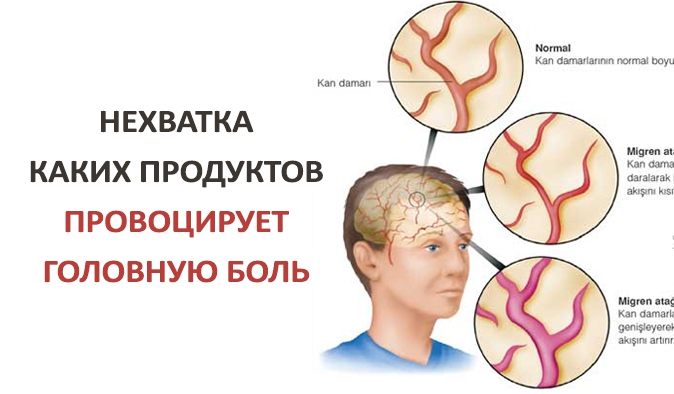 Нехватка каких продуктов провоцирует головную боль