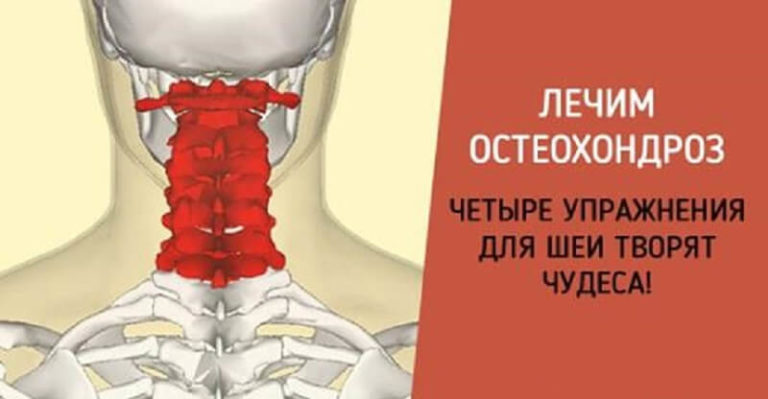 Гимнастика для шеи — четыре шага к гибкости и красоте!