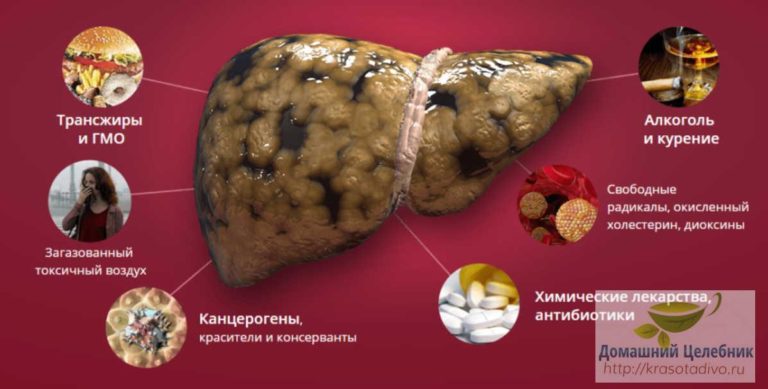 Как разгрузить печень? Вы можете болеть и не знать причины!